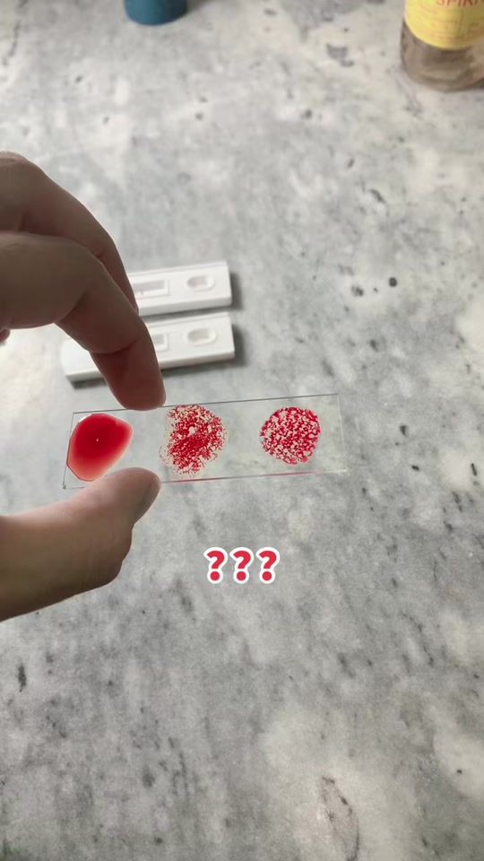 TikTok video thumbnail by dr..sohail.khan