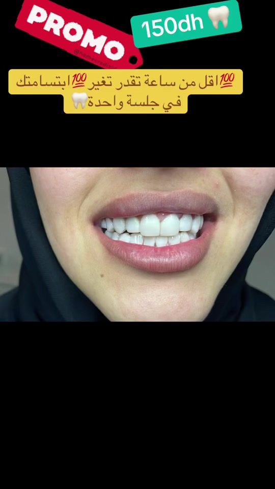 TikTok video thumbnail by hasnaa.smile
