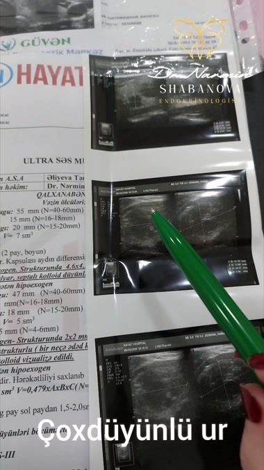 TikTok video thumbnail by nermin.shabanova