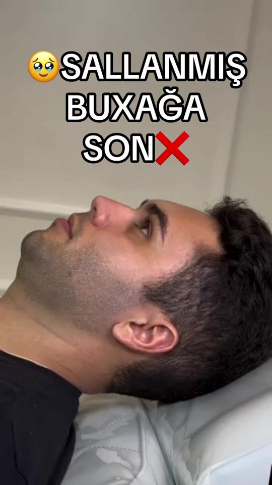 TikTok video thumbnail by dr.amrahmehdiyev