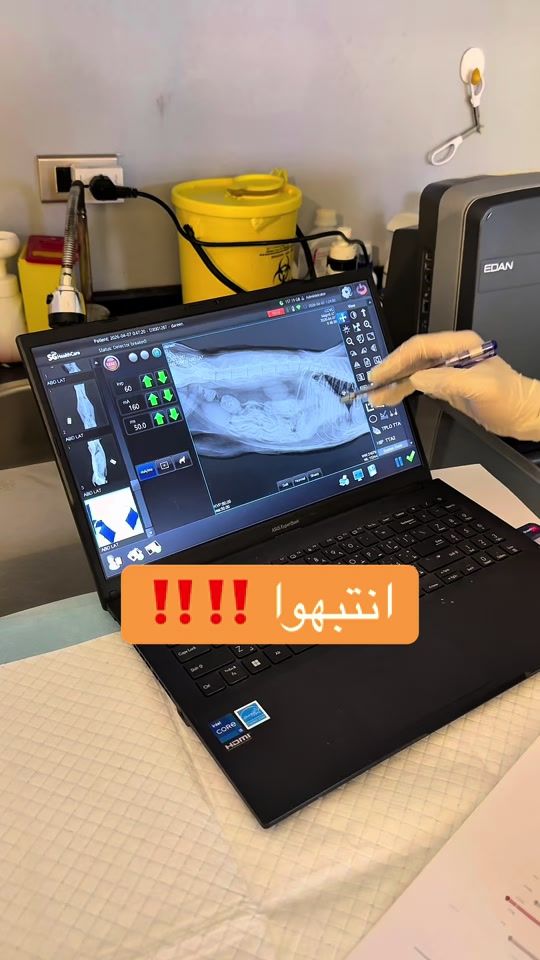 TikTok video thumbnail by dareeneskandar