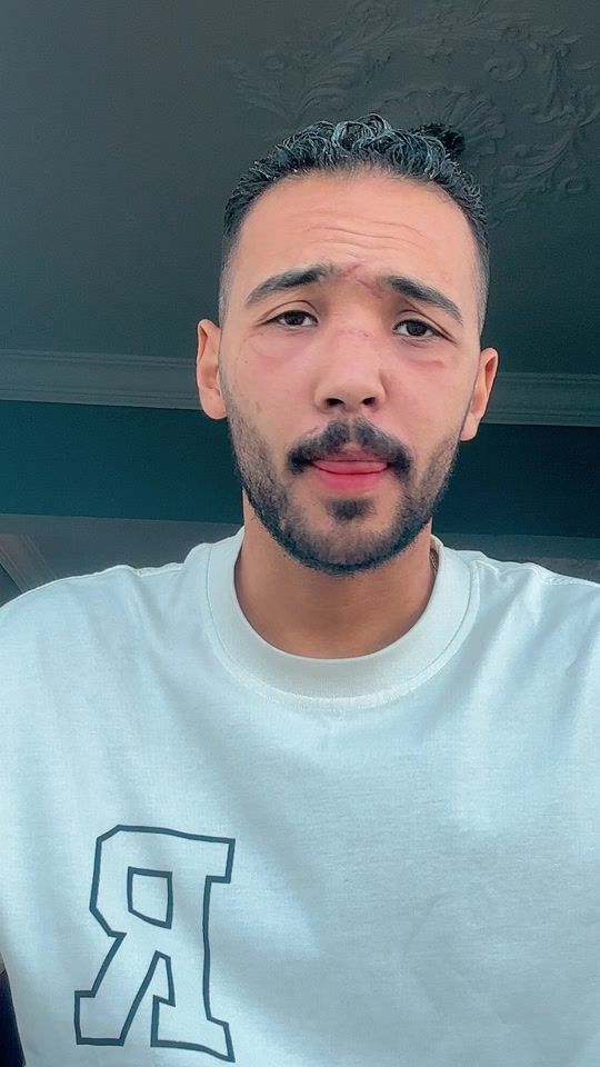TikTok video thumbnail by mahmoudtarek32