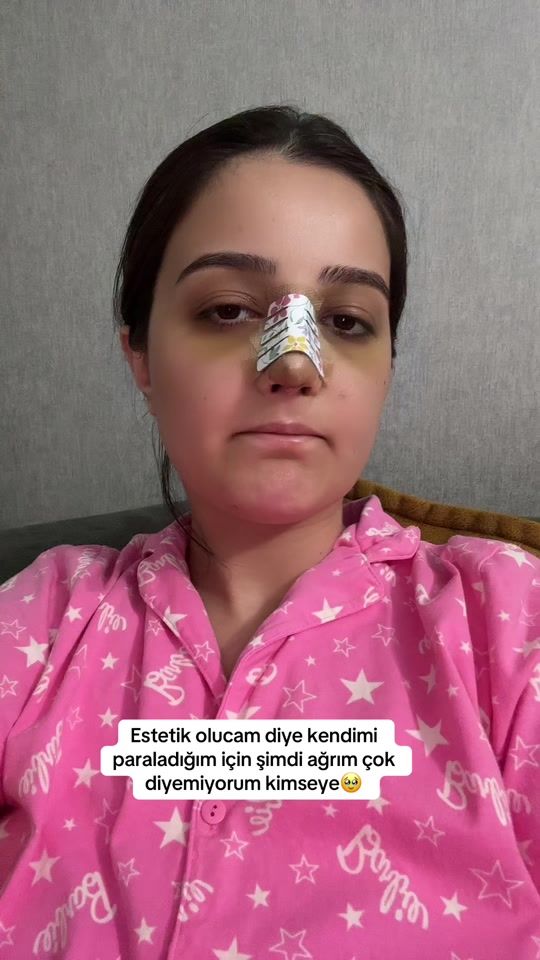 TikTok video thumbnail by huseyinnazrinlive