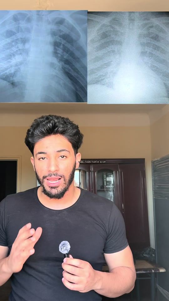 TikTok video thumbnail by dr_sabeur7