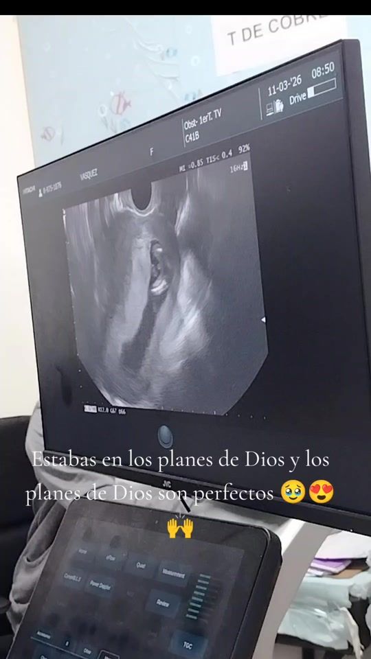 TikTok video thumbnail by indiramichelle21