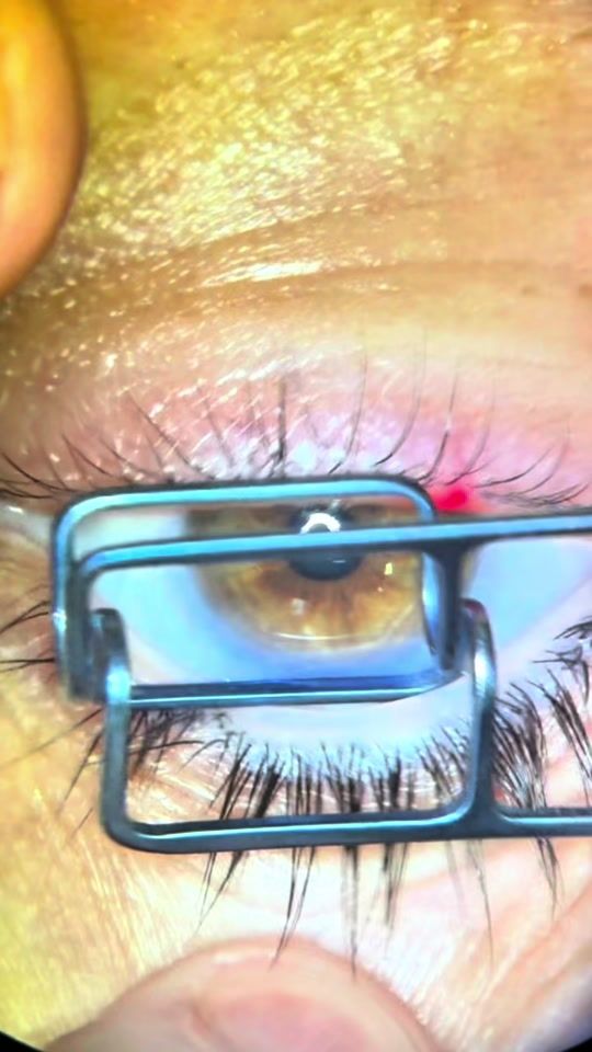 TikTok video thumbnail by drdavidcid