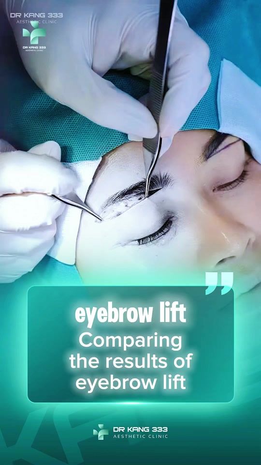 TikTok video thumbnail by dr.kang333