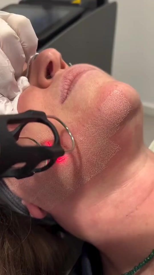 TikTok video thumbnail by dr_kfelati