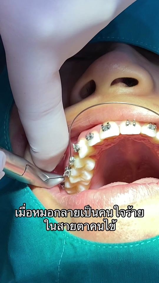 TikTok video thumbnail by 32dentalclinic.th
