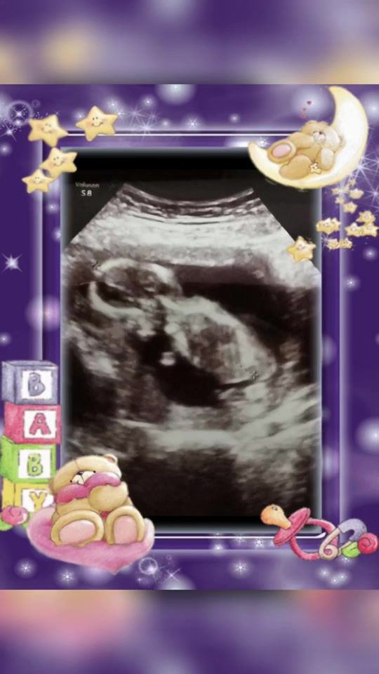 TikTok video thumbnail by askarol2