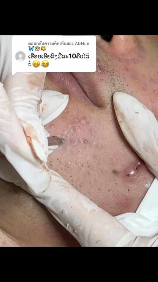 TikTok video thumbnail by f.b_ninginthila