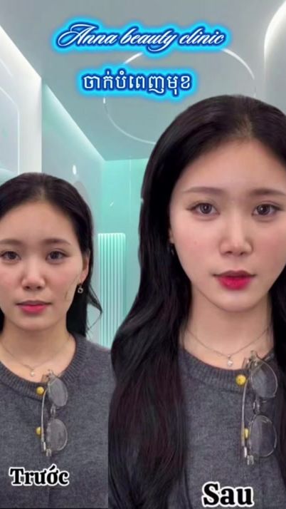TikTok video thumbnail by ana56beauty.kh
