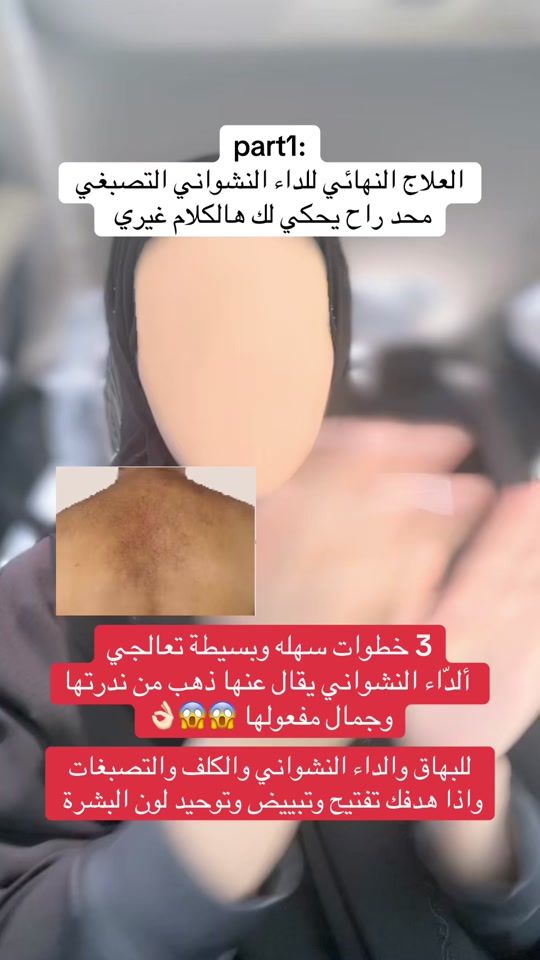 TikTok video thumbnail by queenqmegdf