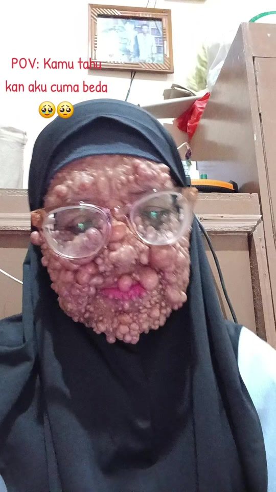 TikTok video thumbnail by rinha_rini_vmf
