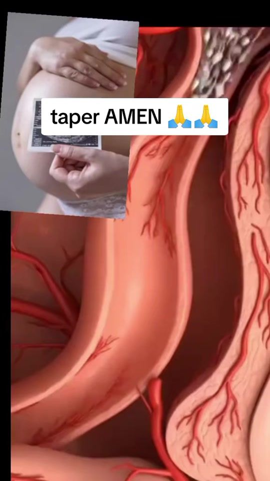 TikTok video thumbnail by tomber_enceinte