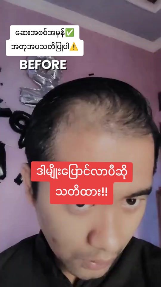 TikTok video thumbnail by khinlay.khk