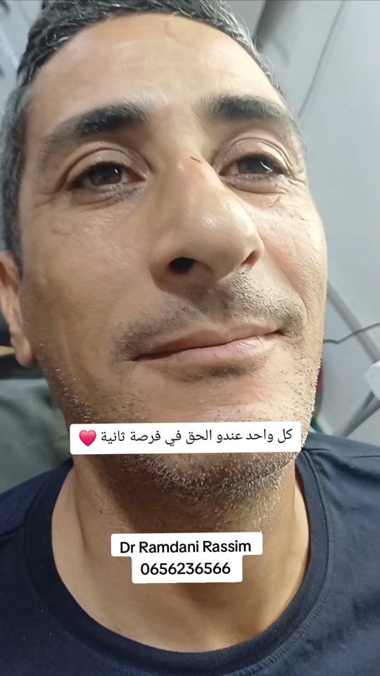 TikTok video thumbnail by ramdani_dental_clinic