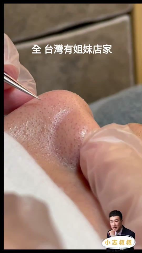 TikTok video thumbnail by acne_master__