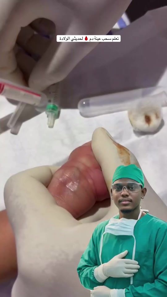 TikTok video thumbnail by ar_icu