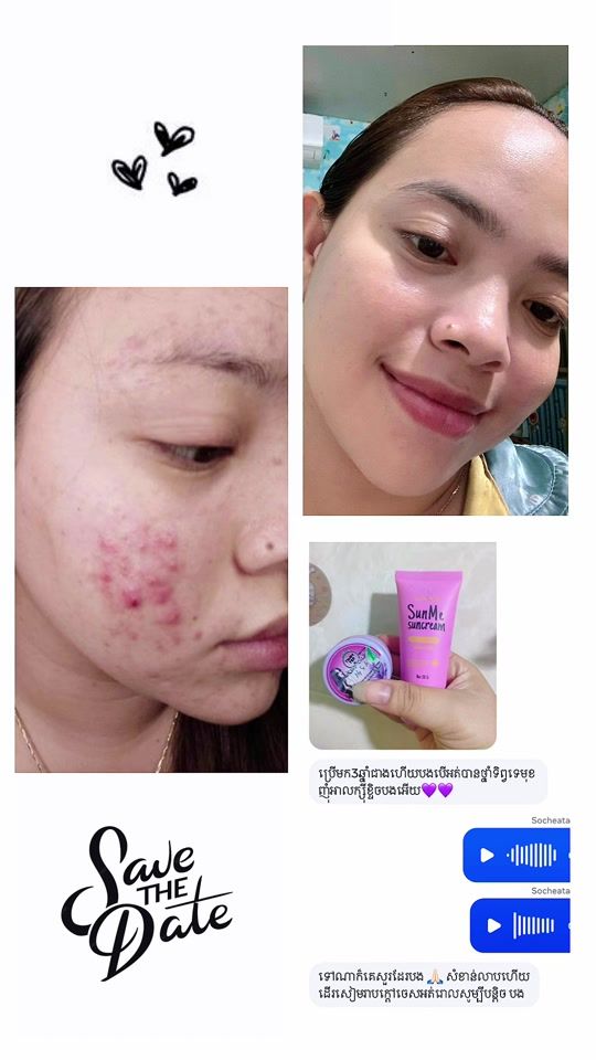 TikTok video thumbnail by socheata_chea