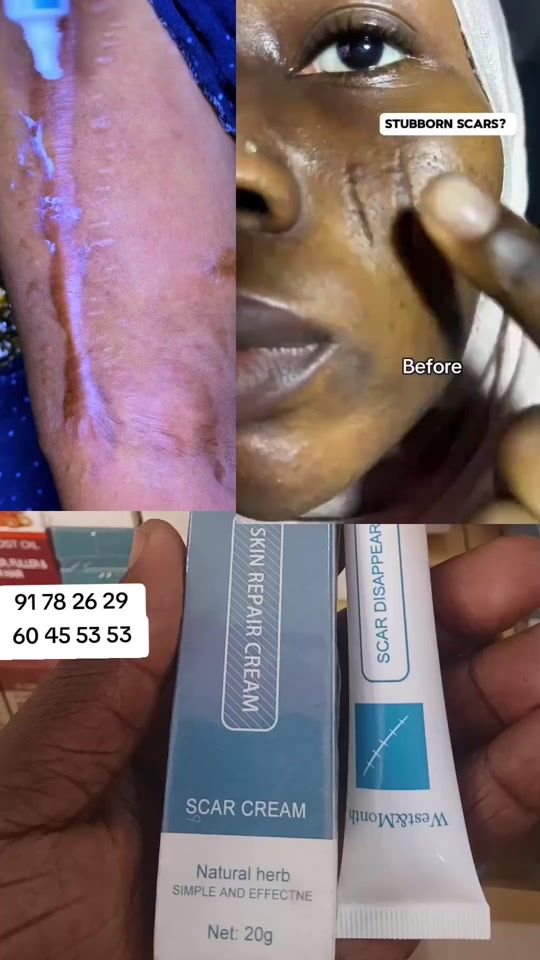 TikTok video thumbnail by ecommerce.birra.a
