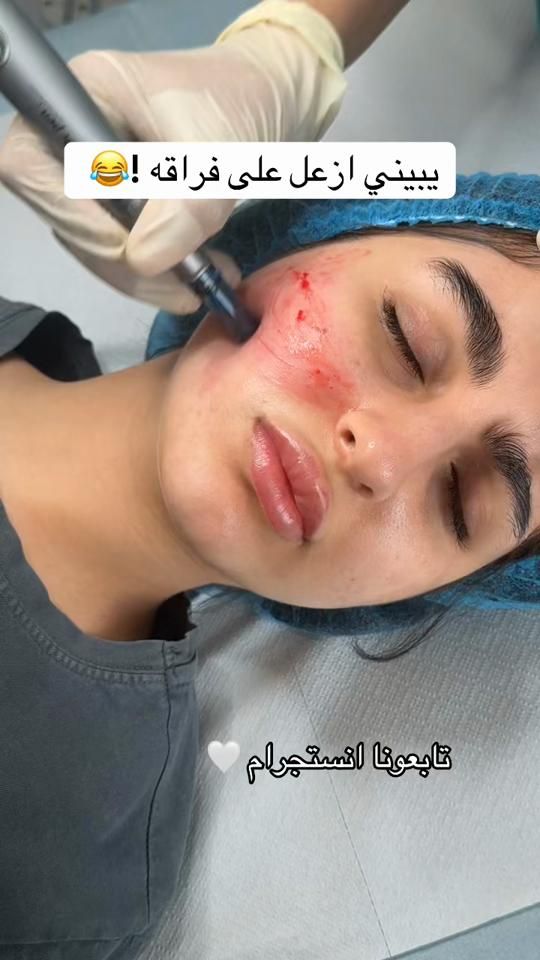 TikTok video thumbnail by beirutclinic