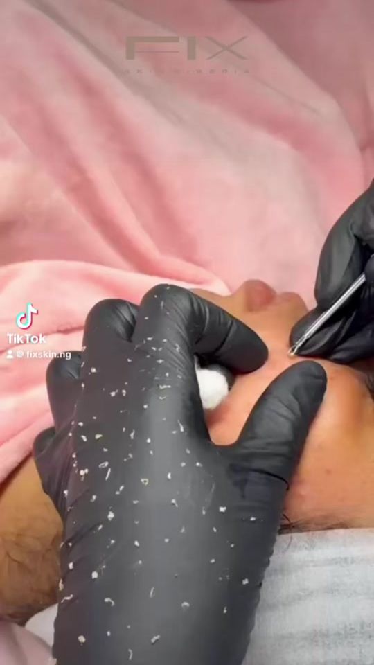 TikTok video thumbnail by fixskin.ng