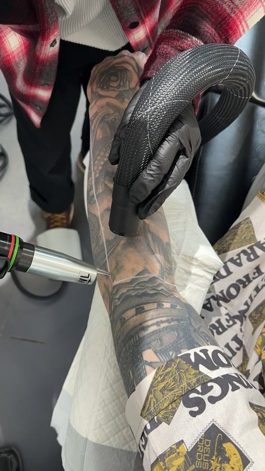 TikTok video thumbnail by swlasertattooremoval