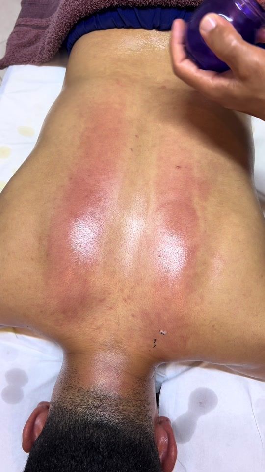 TikTok video thumbnail by physio_nabil