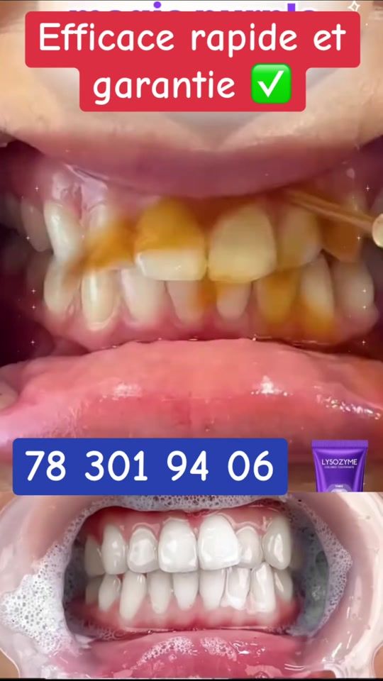 TikTok video thumbnail by pa.a.thiam