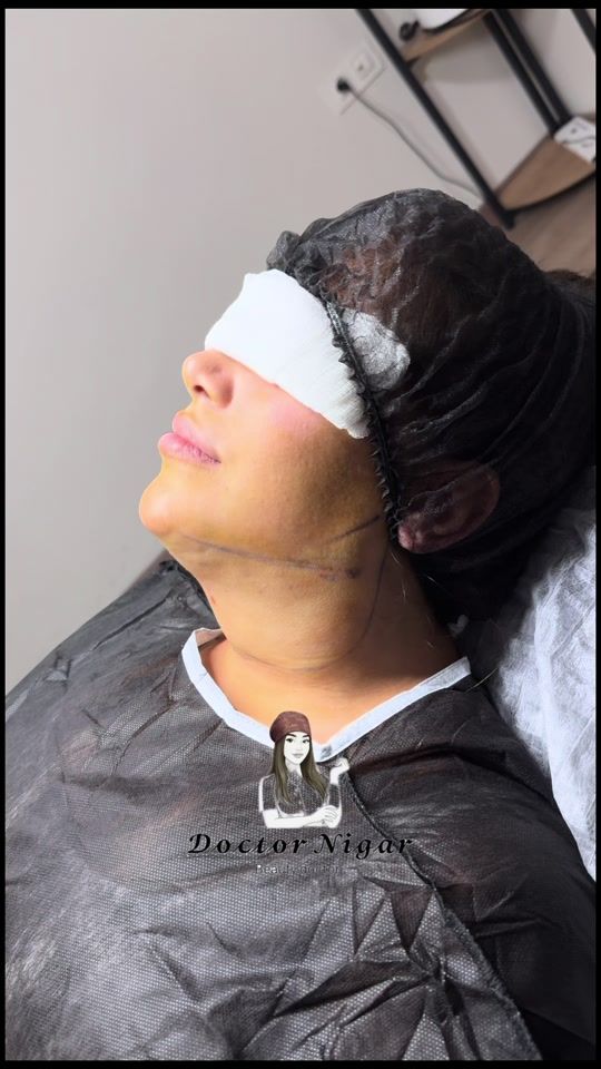 TikTok video thumbnail by dr.nigar.surgery