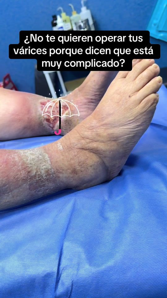 TikTok video thumbnail by dr.danteramosd