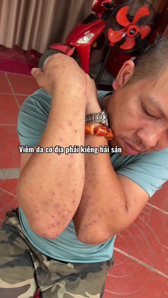 TikTok video thumbnail by thituyendc35.vn