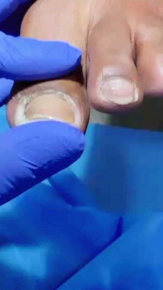 TikTok video thumbnail by drdetuspies