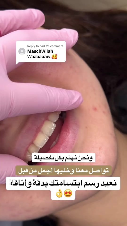 TikTok video thumbnail by brightsmileee1