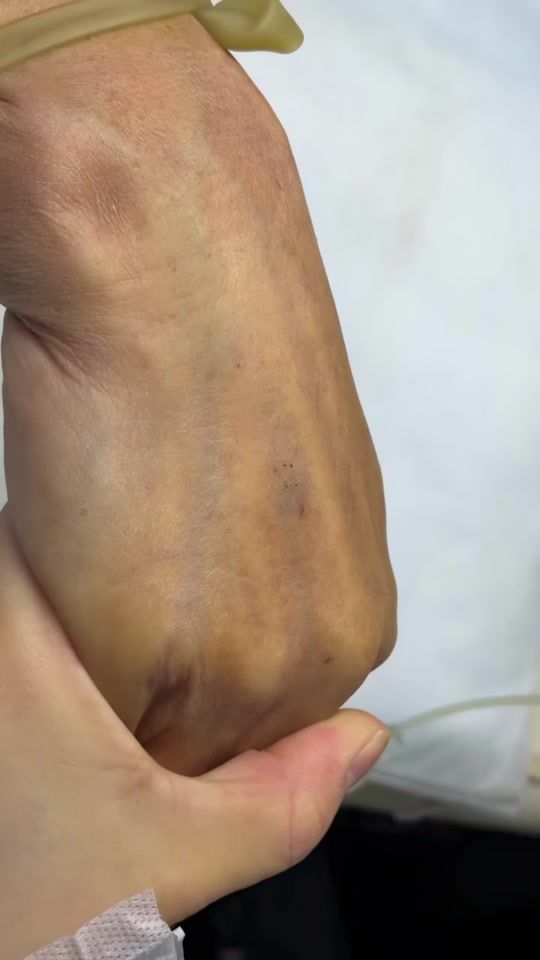 TikTok video thumbnail by dr.qiu5
