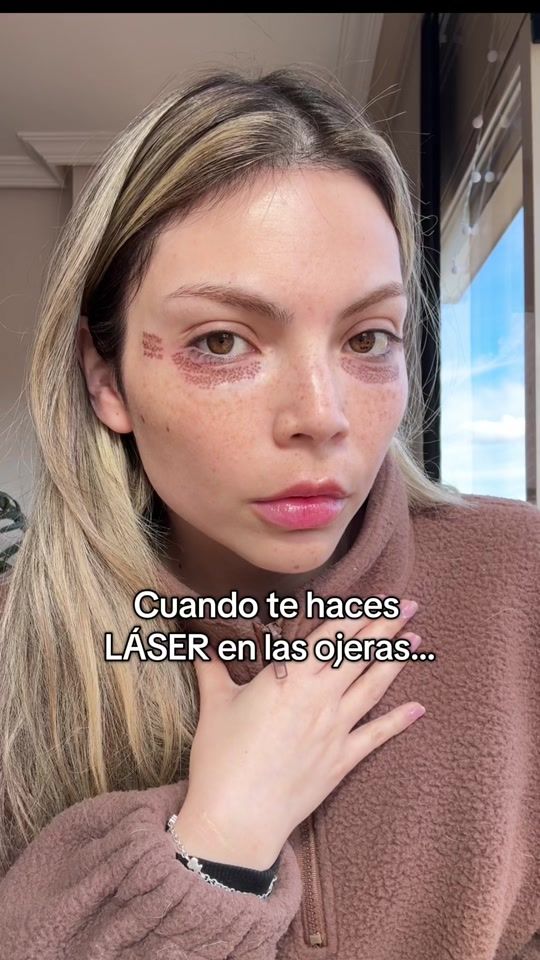 TikTok video thumbnail by eluniverso.defran