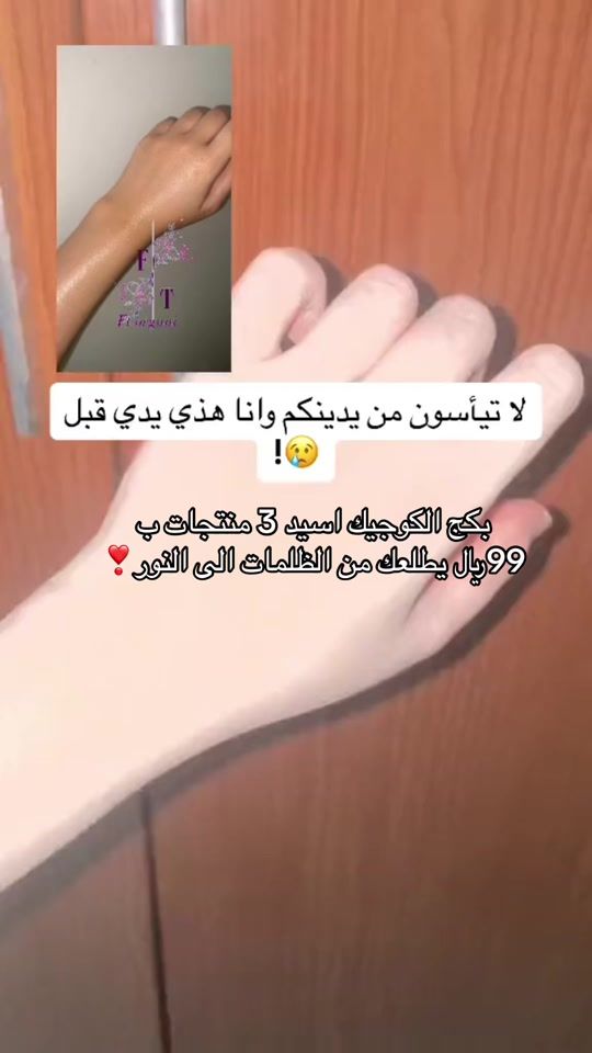 TikTok video thumbnail by ft.organic