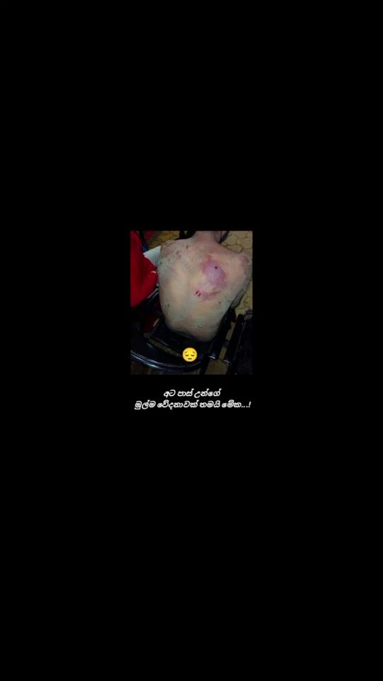TikTok video thumbnail by nethuwa390