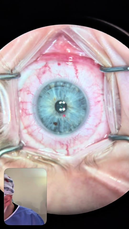 TikTok video thumbnail by dr.kastro