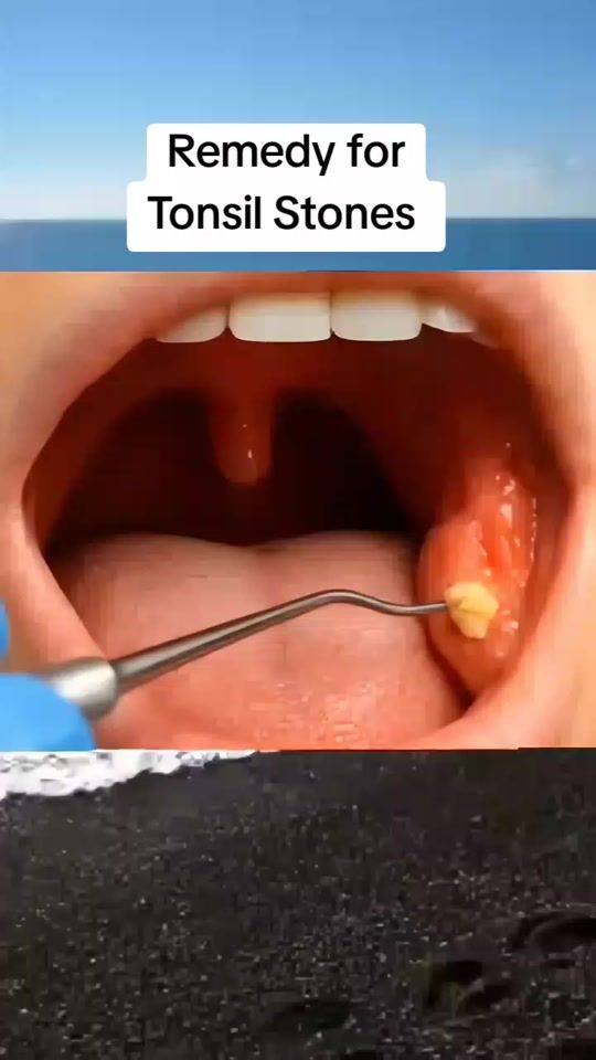 TikTok video thumbnail by deremedist