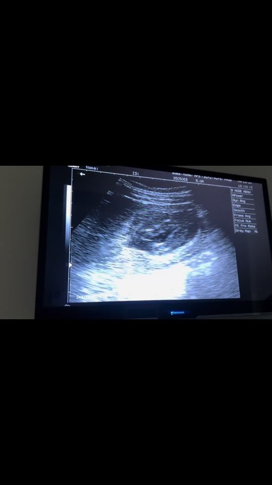 TikTok video thumbnail by lisbeht.3
