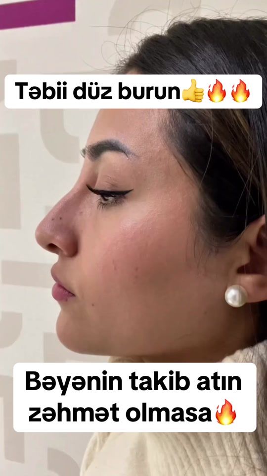 TikTok video thumbnail by dr.rino.med