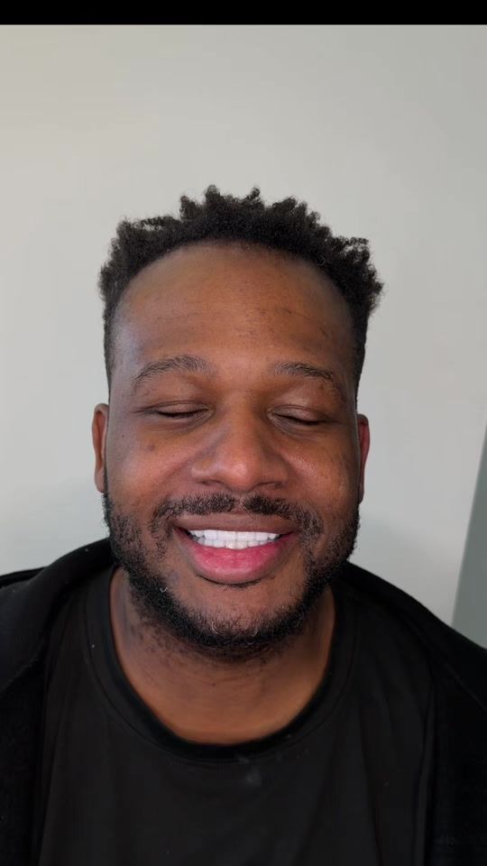 TikTok video thumbnail by arcdentistry