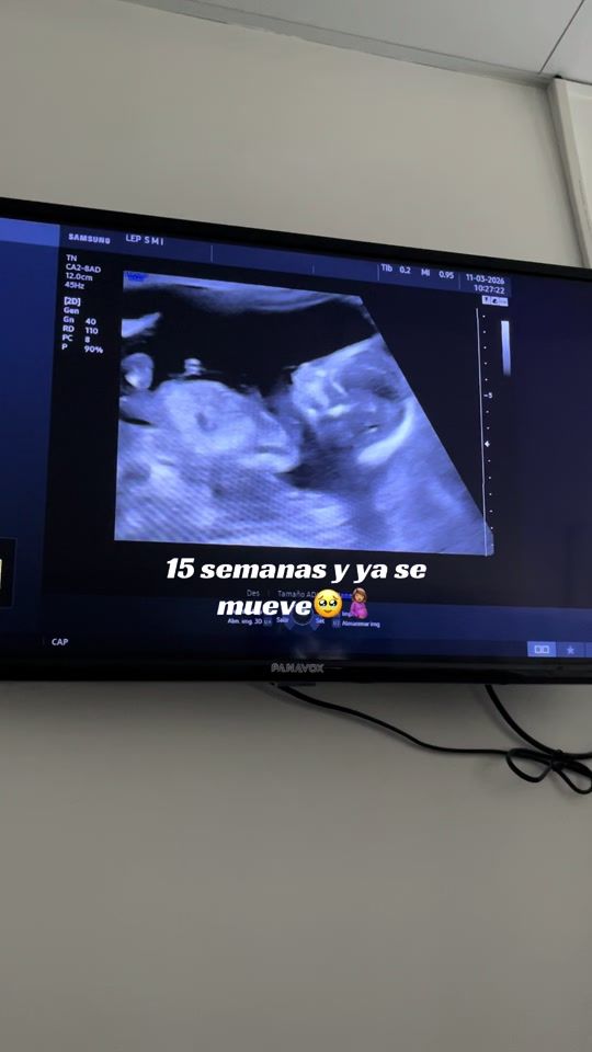 TikTok video thumbnail by celesteeokk