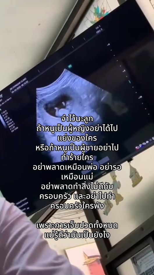 TikTok video thumbnail by a_o_y_r_i_s