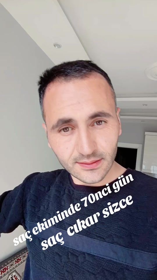 TikTok video thumbnail by tiktokcumeto