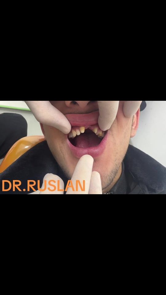 TikTok video thumbnail by dr.ruslan