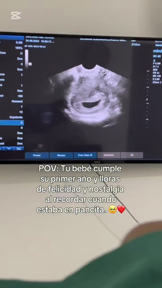 TikTok video thumbnail by alondraorozcos