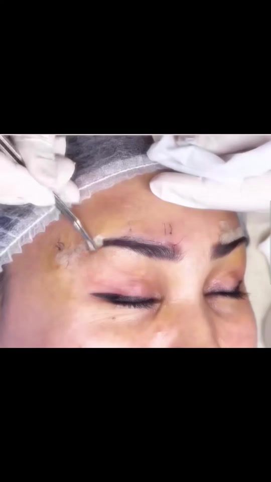 TikTok video thumbnail by uzman.doktorlar
